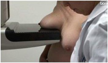 Mammographie bei Frauen ab 50 Jahre